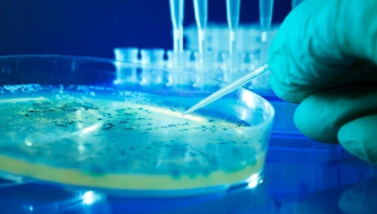 abdde salmonella alarmi sNwxT2Rn